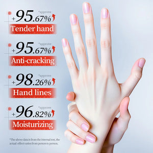 3/5pcs SADOER 10% Urea Anti-Cracking Hand Cream Panthenol HA Deep Moisturizing Improve Dryness Repair Cracked Hands Skincare 30g