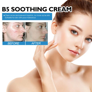 1/3/5PCS B5 Moisturizing Cream Hydrating Solves Dry Chapped Red Skin Nourishing Improve Sunscreen Korean Beauty Face Skin Care