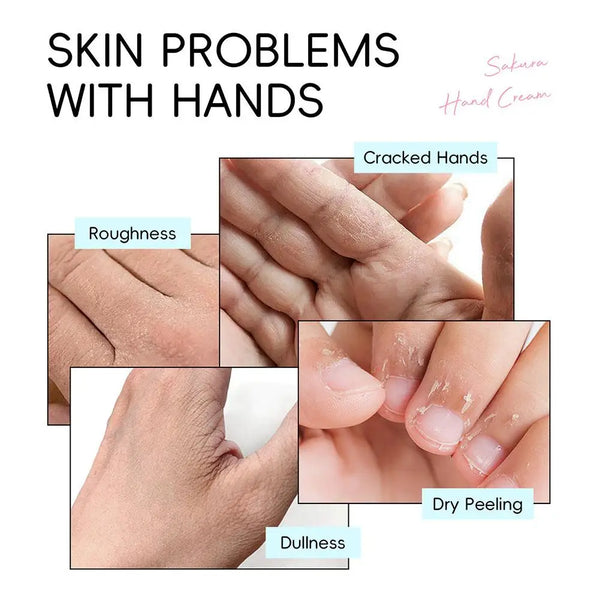 LAIKOU Sakura Hand Cream Deep Moisturizing & Restoring Hand Lotion for Dry Skin,Non-Greasy, Fast Absorbing Hand Care Cream
