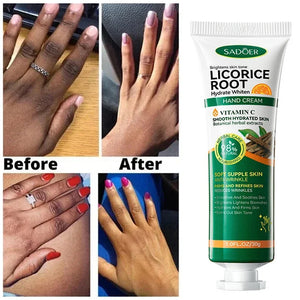 Fast Brighten Dark Knuckles Cream Whiting Hand Cream Lighten Melanin Stains Corrector Hand Anti Crack Soften Moisturize Product