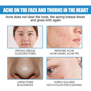 1/3/5PCS B5 Moisturizing Cream Hydrating Solves Dry Chapped Red Skin Nourishing Improve Sunscreen Korean Beauty Face Skin Care