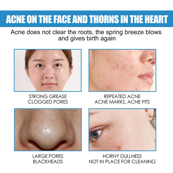 1/3/5PCS B5 Moisturizing Cream Hydrating Solves Dry Chapped Red Skin Nourishing Improve Sunscreen Korean Beauty Face Skin Care