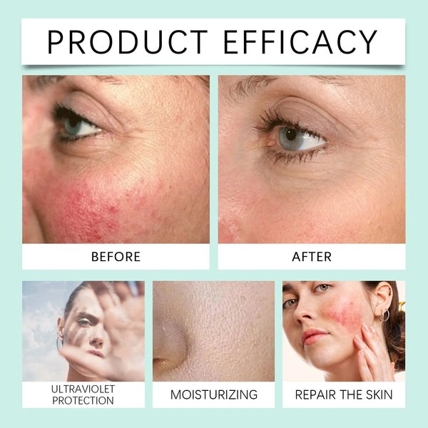 Anti Sun Cream SPF50 UV Defense Broad Spectrum Sunlight Protection Reduce Redness Hydrating Waterproof Prevent Sunburn Sunscreen