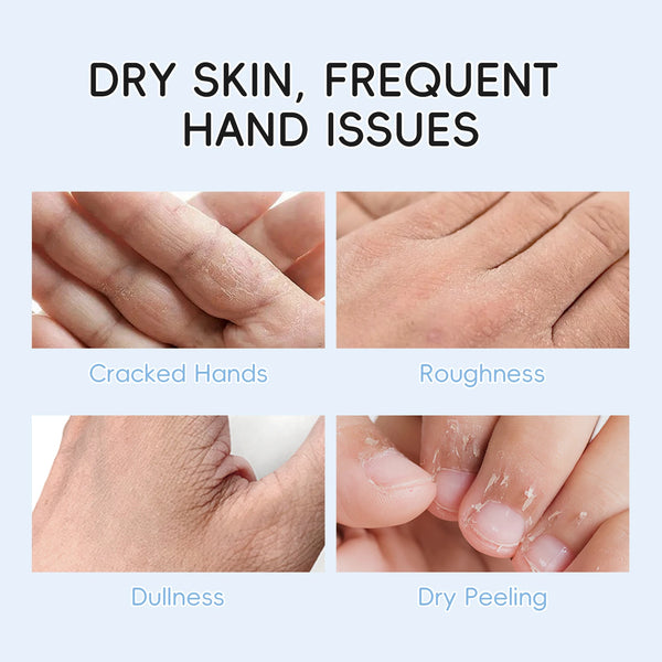 LAIKOU Milk Hand Cream Intensive Hydration Fast-Absorbing Smoothing Repair Dry Cracked Skin Vitamin C Enriched